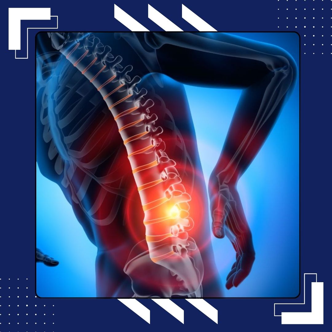 Як плоскостопість впливає на коліна та поперек