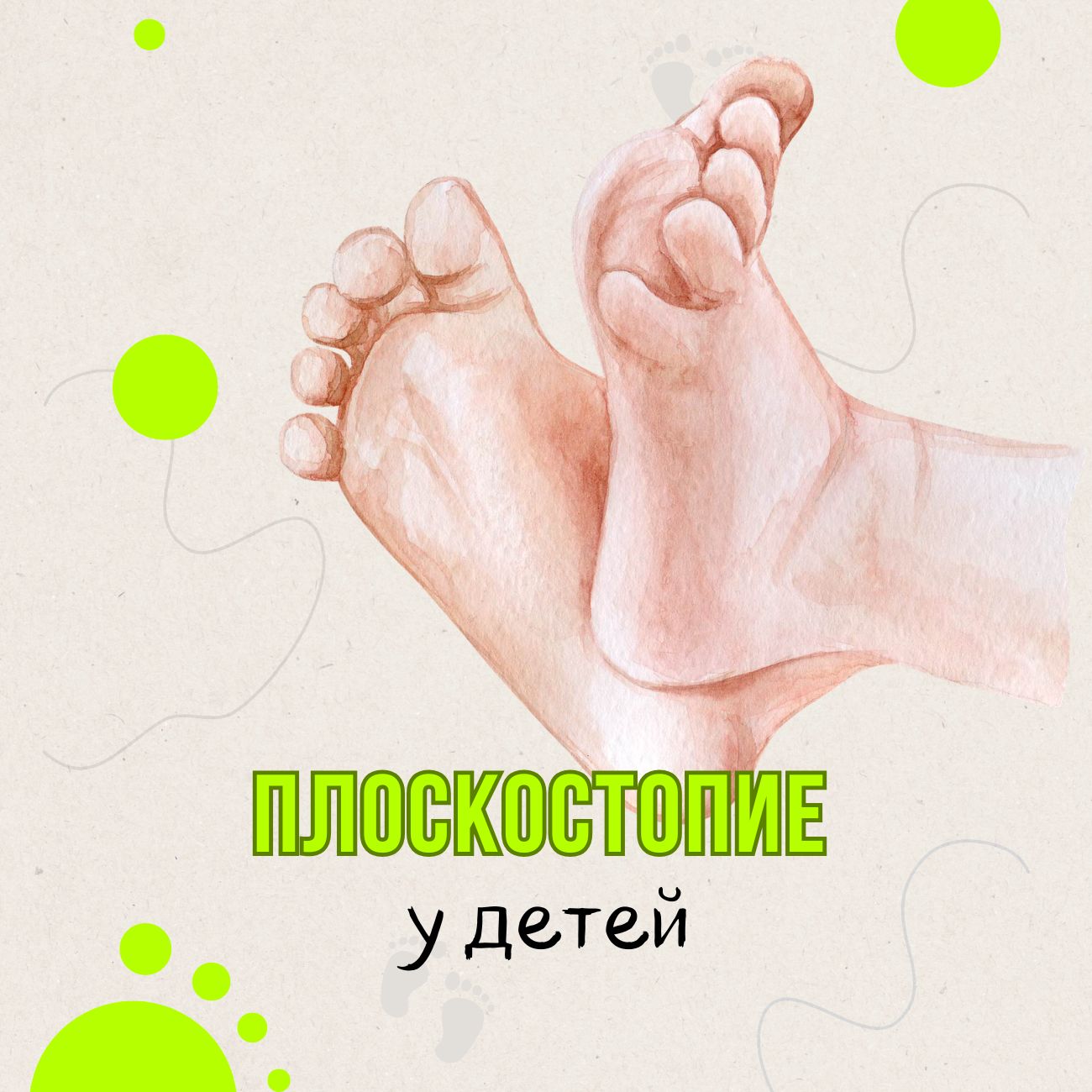 Плоскостопие у детей когда это норма и когда нужна коррекция